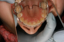 Ortodontie